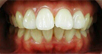 Before