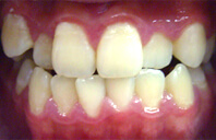 Before