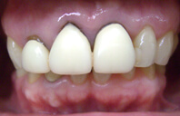 Before