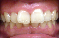 Before