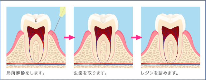 工程