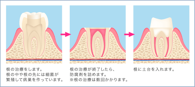 大きい工程1