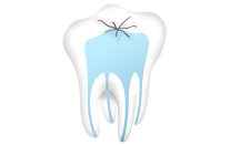 奥歯の根のイメージ