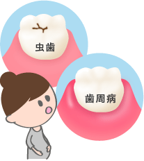 妊婦の虫歯や歯周病のイメージ