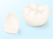 セラミックの歯のイメージ