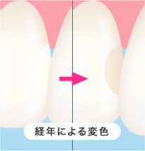 数年による変色のイメージ