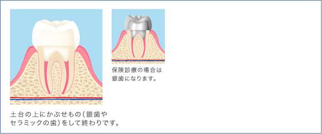 工程2日目