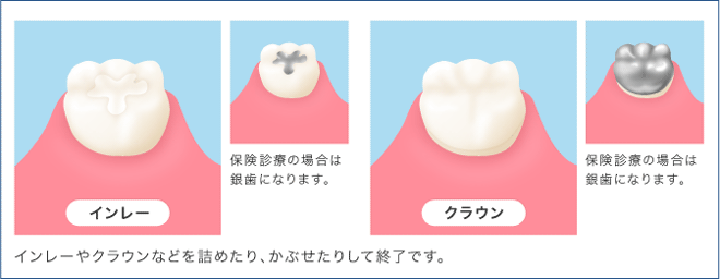 C2治療工程4日目