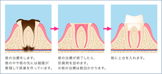 C41日目