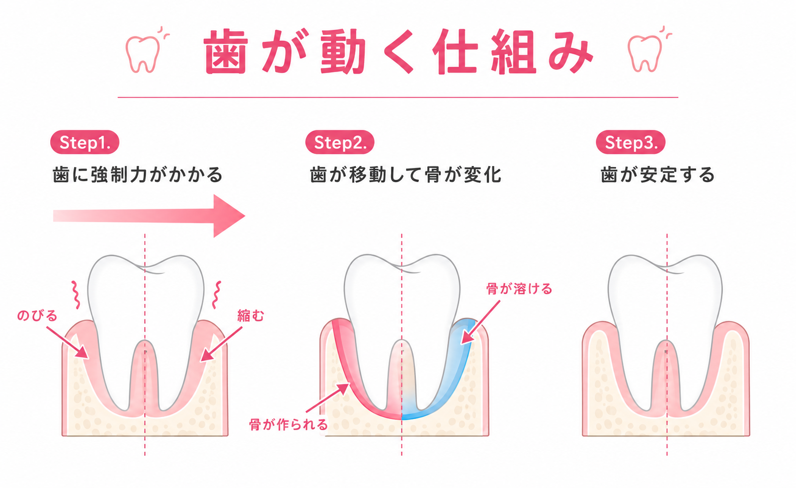 歯が動く仕組み