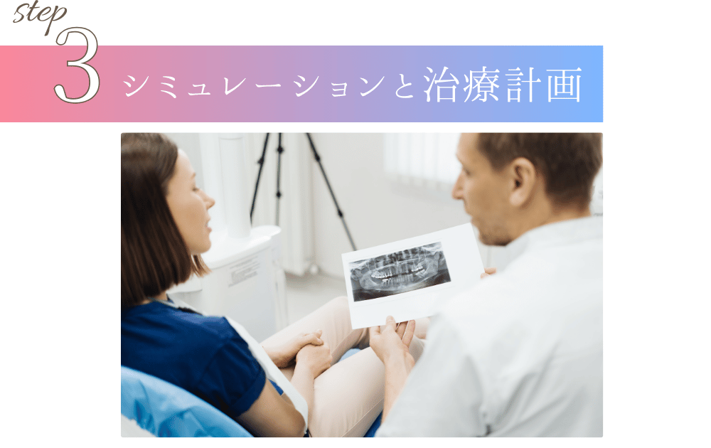 シミュレーションと治療計画