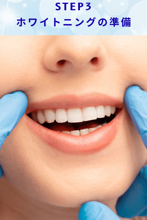 ステップ3：ホワイトニングの準備