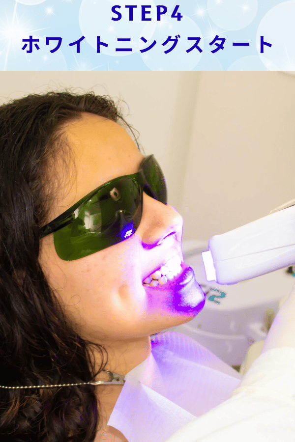 ステップ4：ホワイトニングスタート