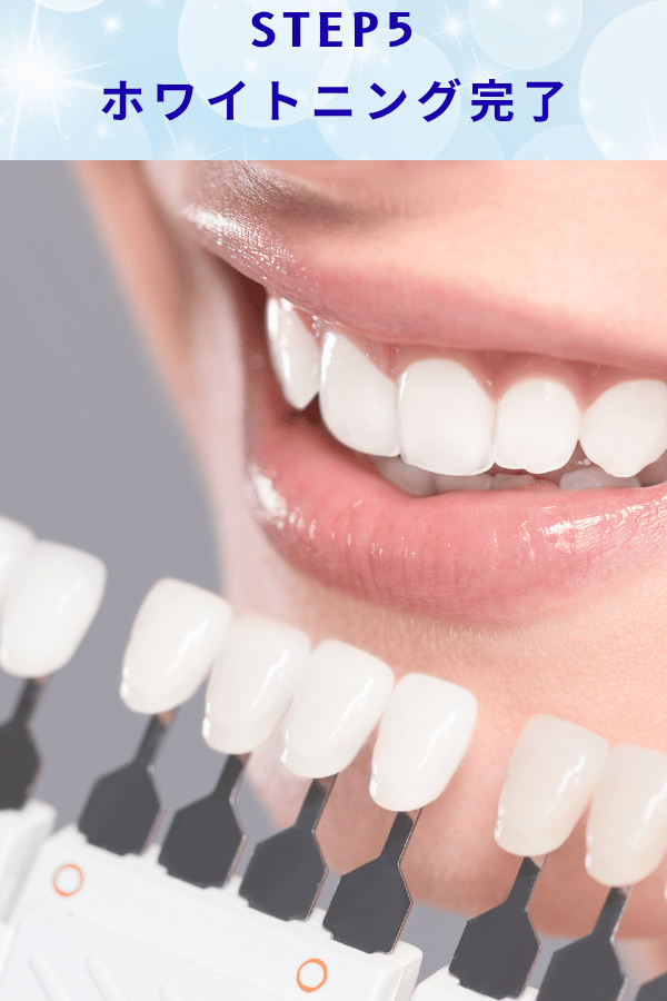 ステップ5：ホワイトニング完了
