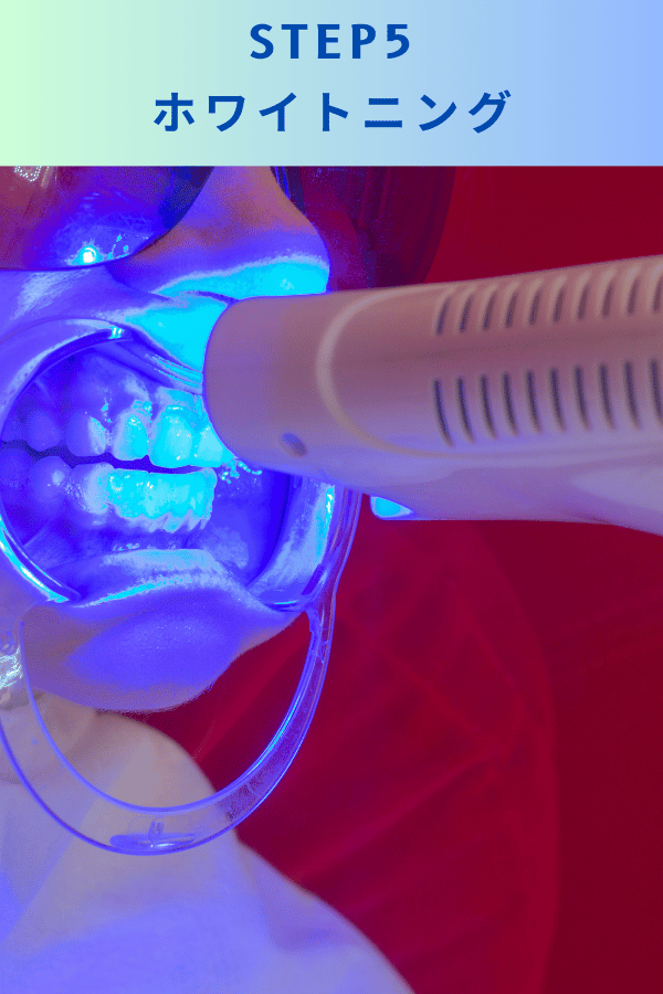 ステップ5：ホワイトニング