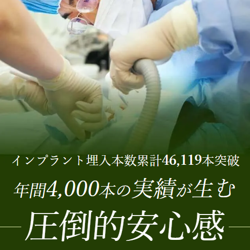 きぬた歯科のインプラント