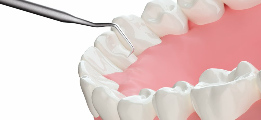 NINE DENTAL 心斎橋PARCO