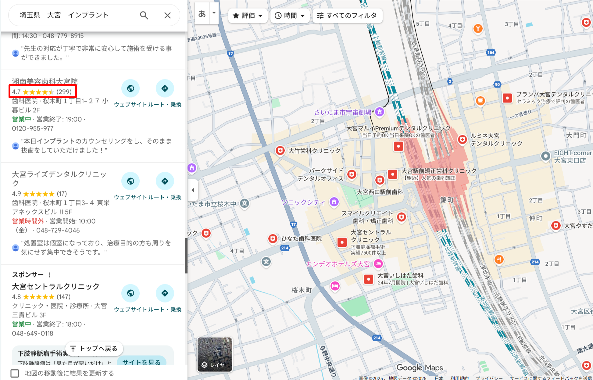 埼玉県大宮でインプラント治療ができる歯科医院のGoogle口コミ評価