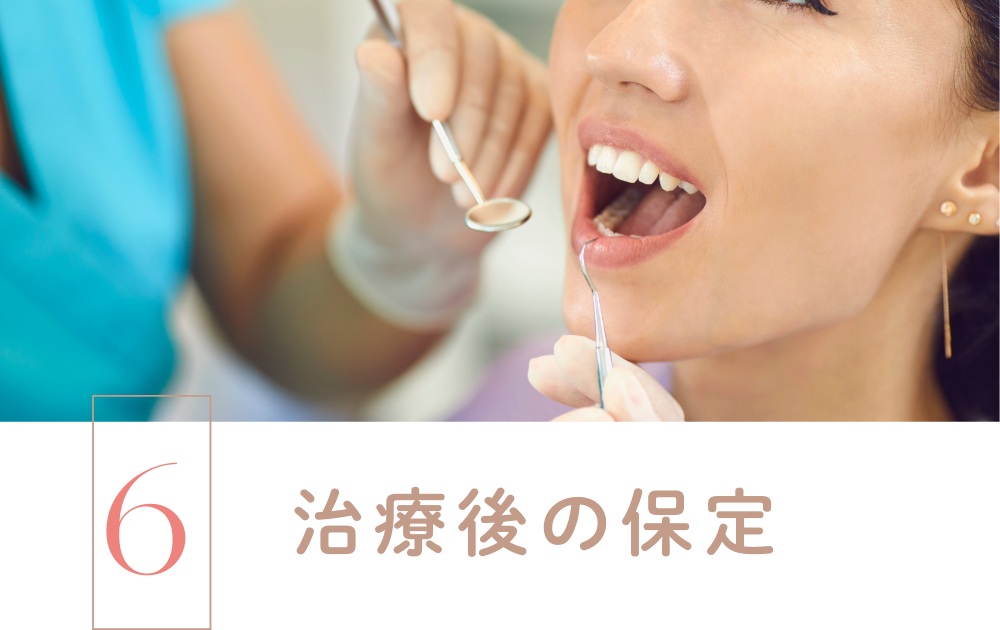 STEP6.治療後の保定