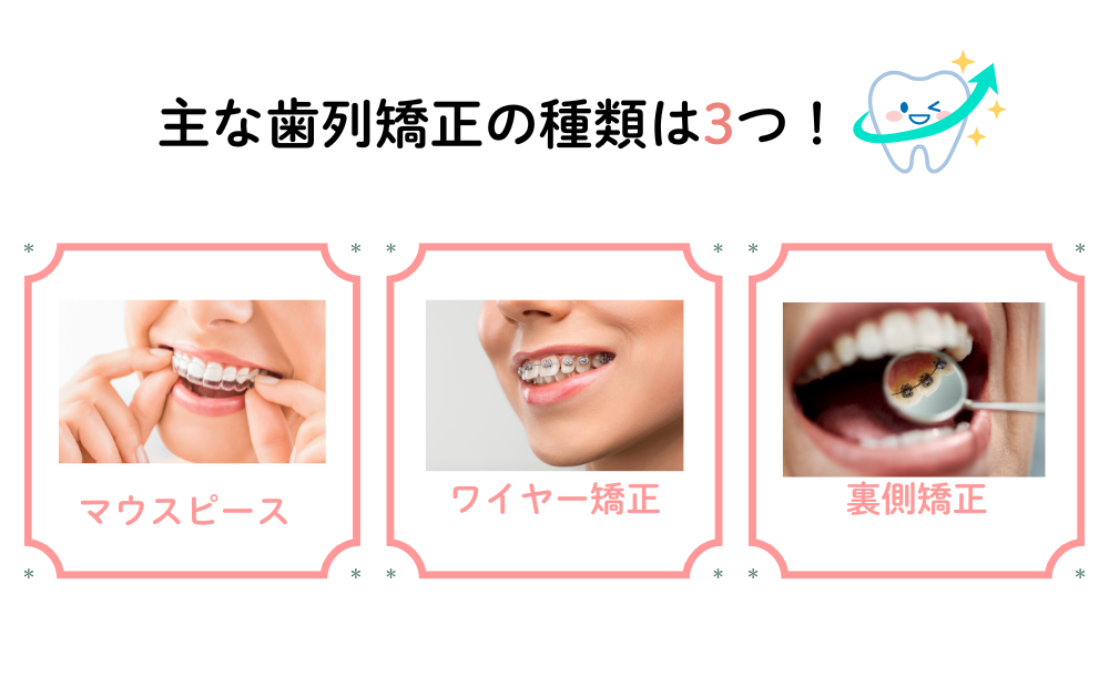 主な歯列矯正の種類は3つ！