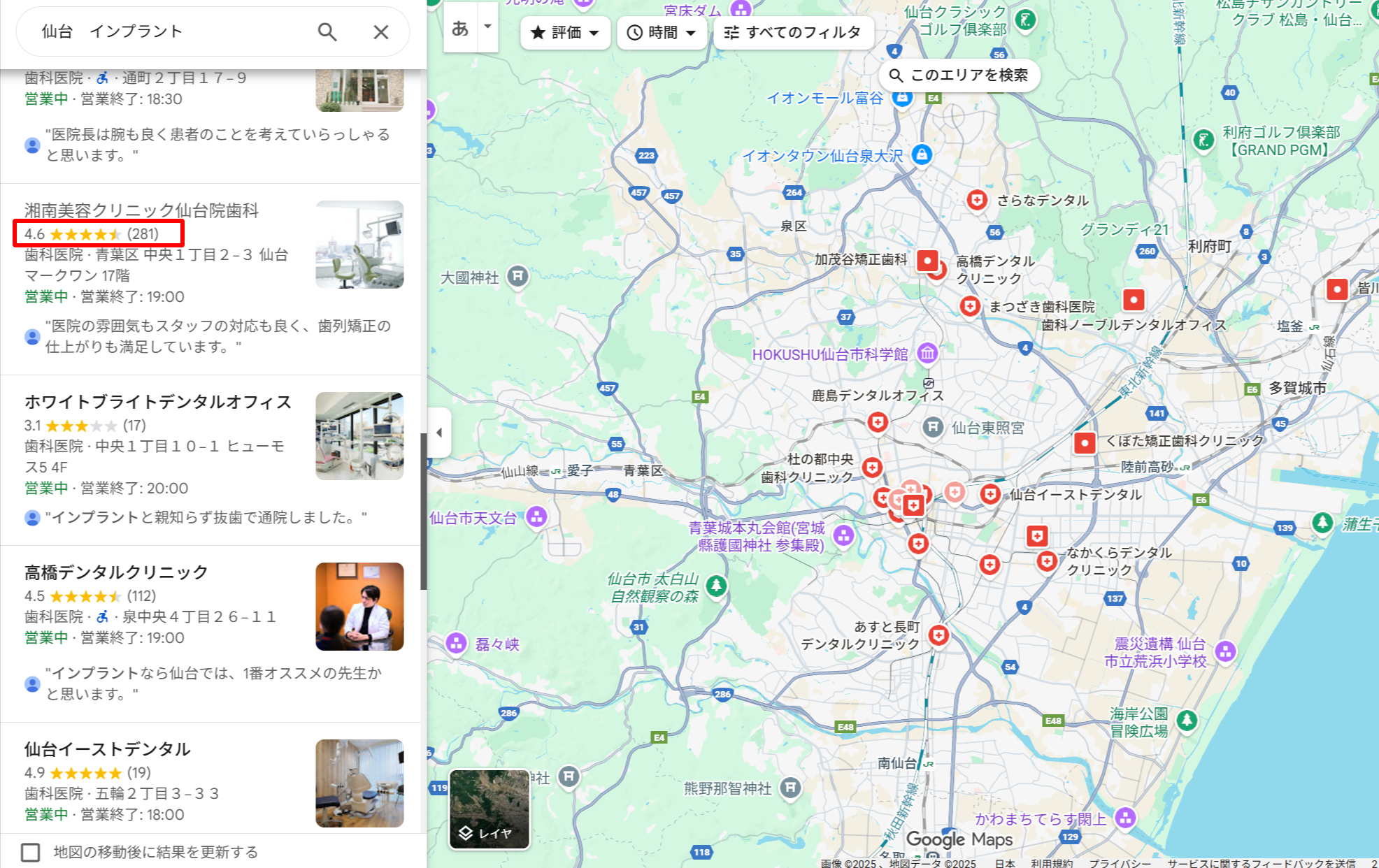 仙台エリアでインプラント治療ができる歯科医院のGoogle口コミ評価