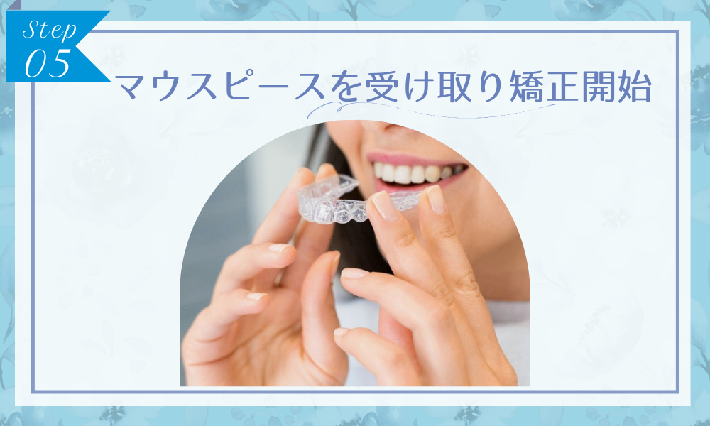 ステップ5：マウスピースを受け取り矯正開始