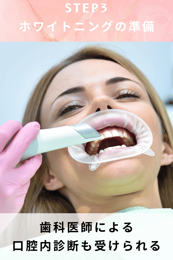 ステップ3：ホワイトニングの準備
