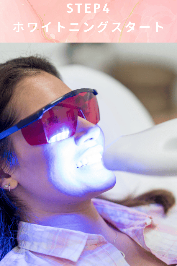 ステップ4：ホワイトニングスタート