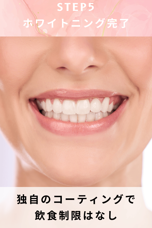 ステップ5：ホワイトニング完了