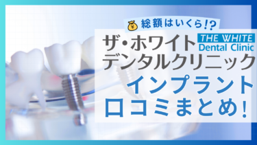 ザ・ホワイトデンタルクリニックのインプラントの口コミまとめ！総額はいくら？