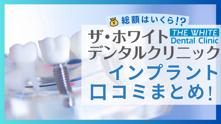 ザ・ホワイトデンタルクリニックのインプラントの口コミまとめ