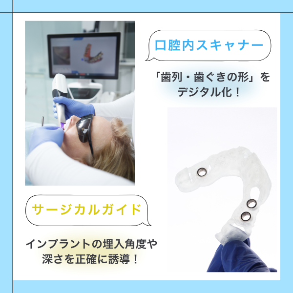 ザ・ホワイトデンタルクリニックで導入している口腔内スキャナーとサージカルガイド