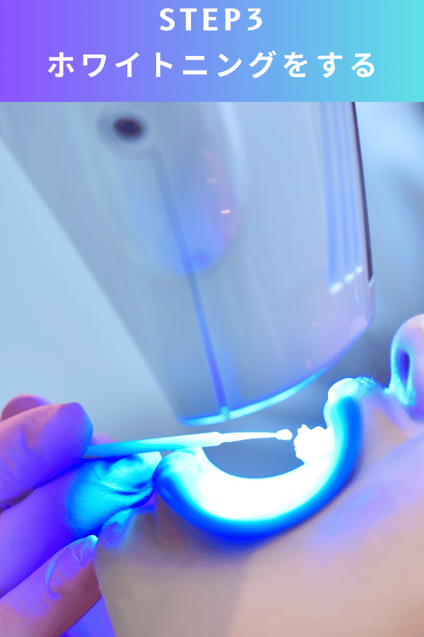 ステップ3：ホワイトニングをする