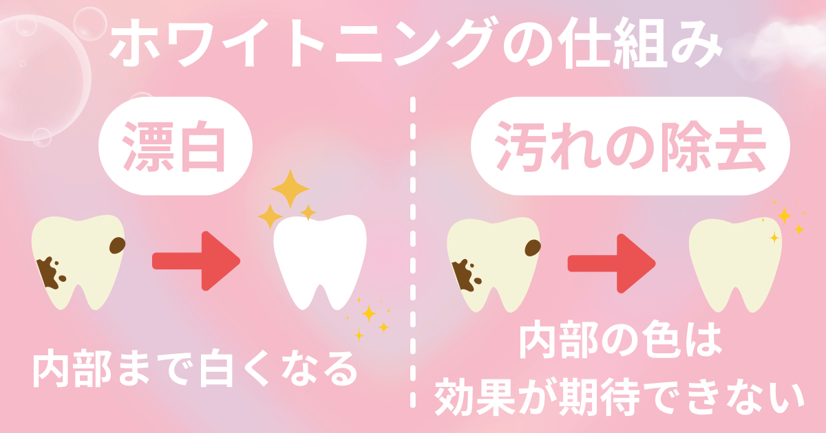 ホワイトニングの仕組み