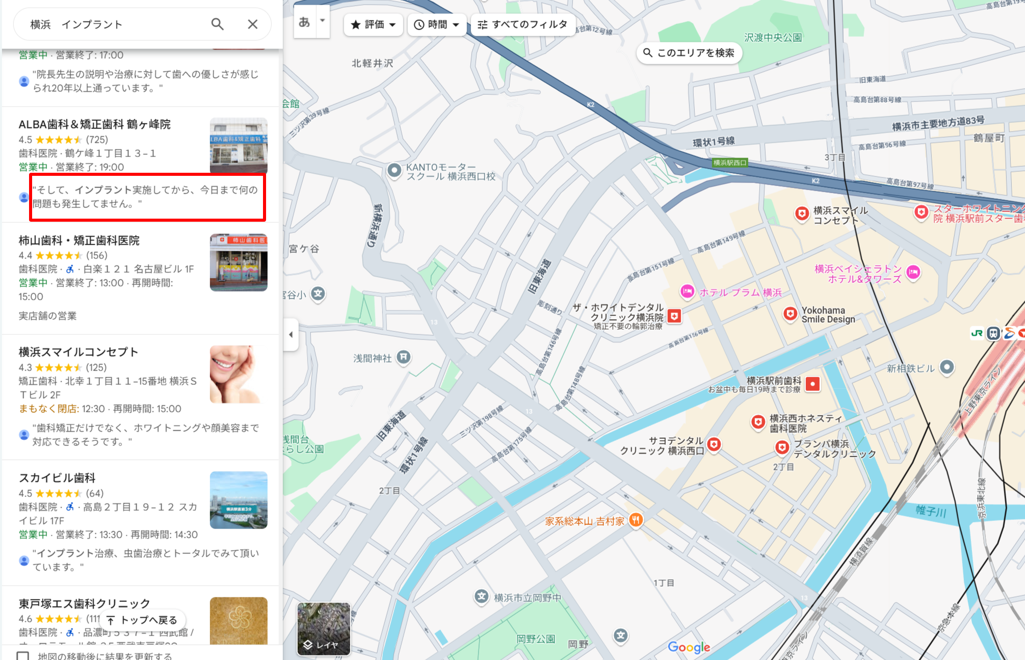 横浜エリアでインプラント治療ができるクリニックのGoogle口コミ評価