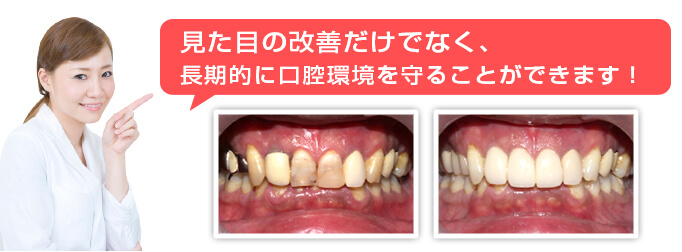 見た目の改善だけでなく、長期的に口腔環境を守ることができます！