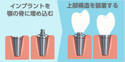 治療法の違い