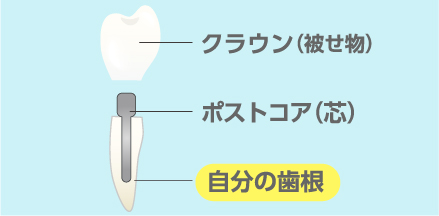 治療法の違い