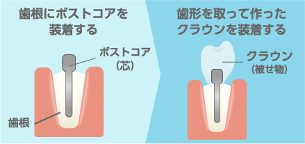 治療法の違い