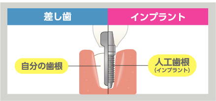 歯の有無