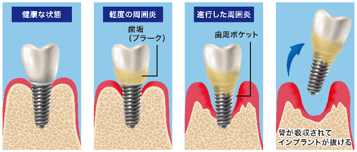 原因