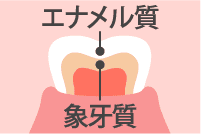 歯の色を決めるのは歯の構造
