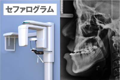 Eラインでの判定方法