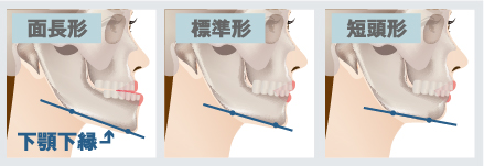 面長・標準・短頭形