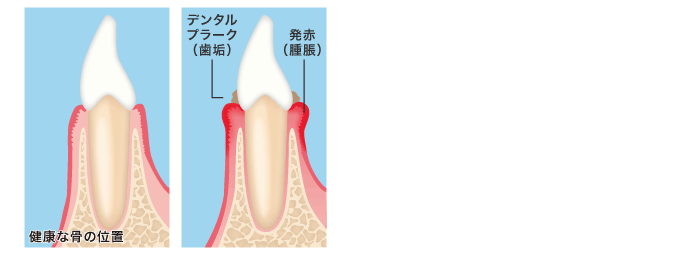 健康な骨の位置