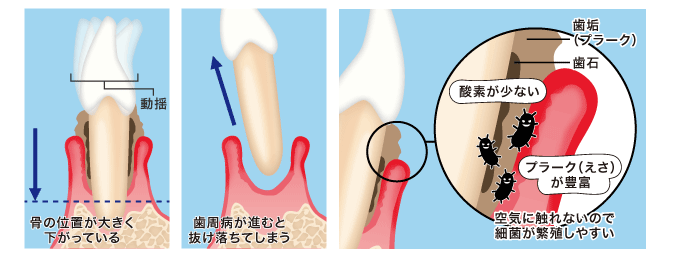 骨の位置が大きく下がっている