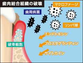 早産、低体重児出産