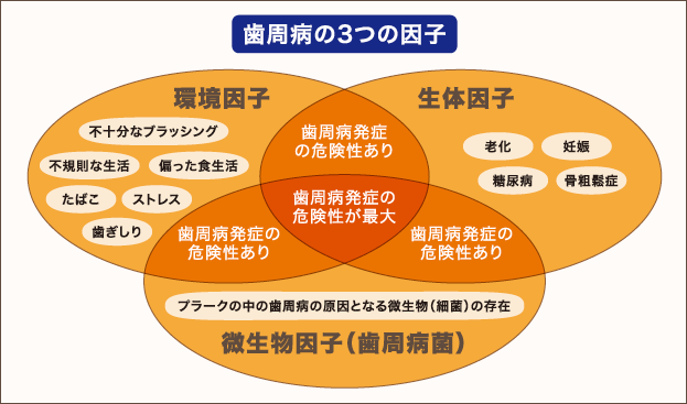 歯周病の3つの因子