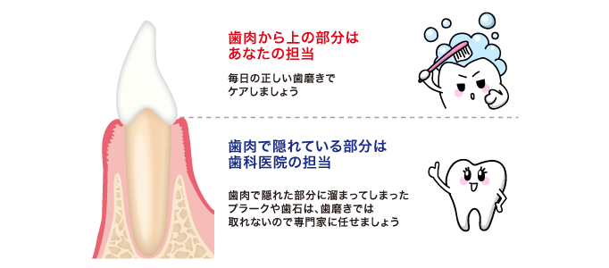 毎日の正しい歯磨きでケアしましょう