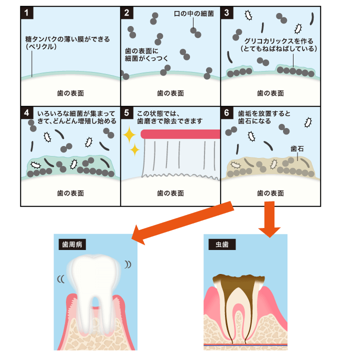 細菌の繁殖